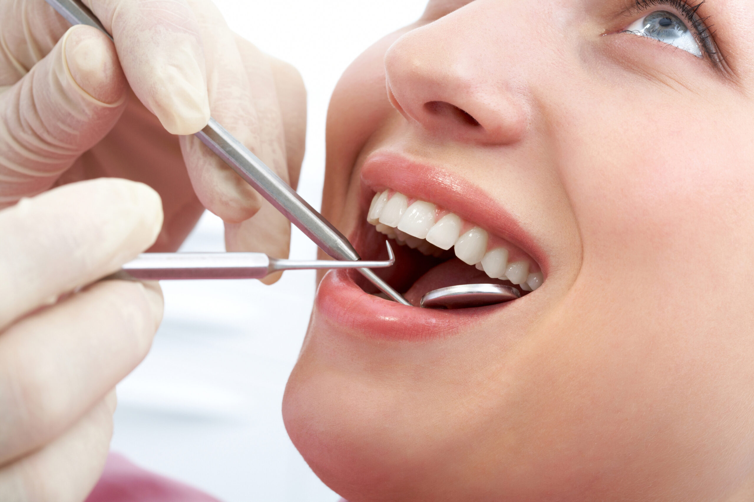 The Process of Getting a Tooth Filled: What to Expect