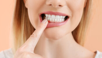 Understanding and Preventing Gum Disease