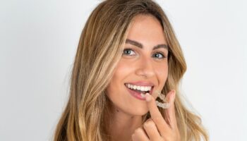 How Invisalign Can Correct Overbites: A Detailed Look