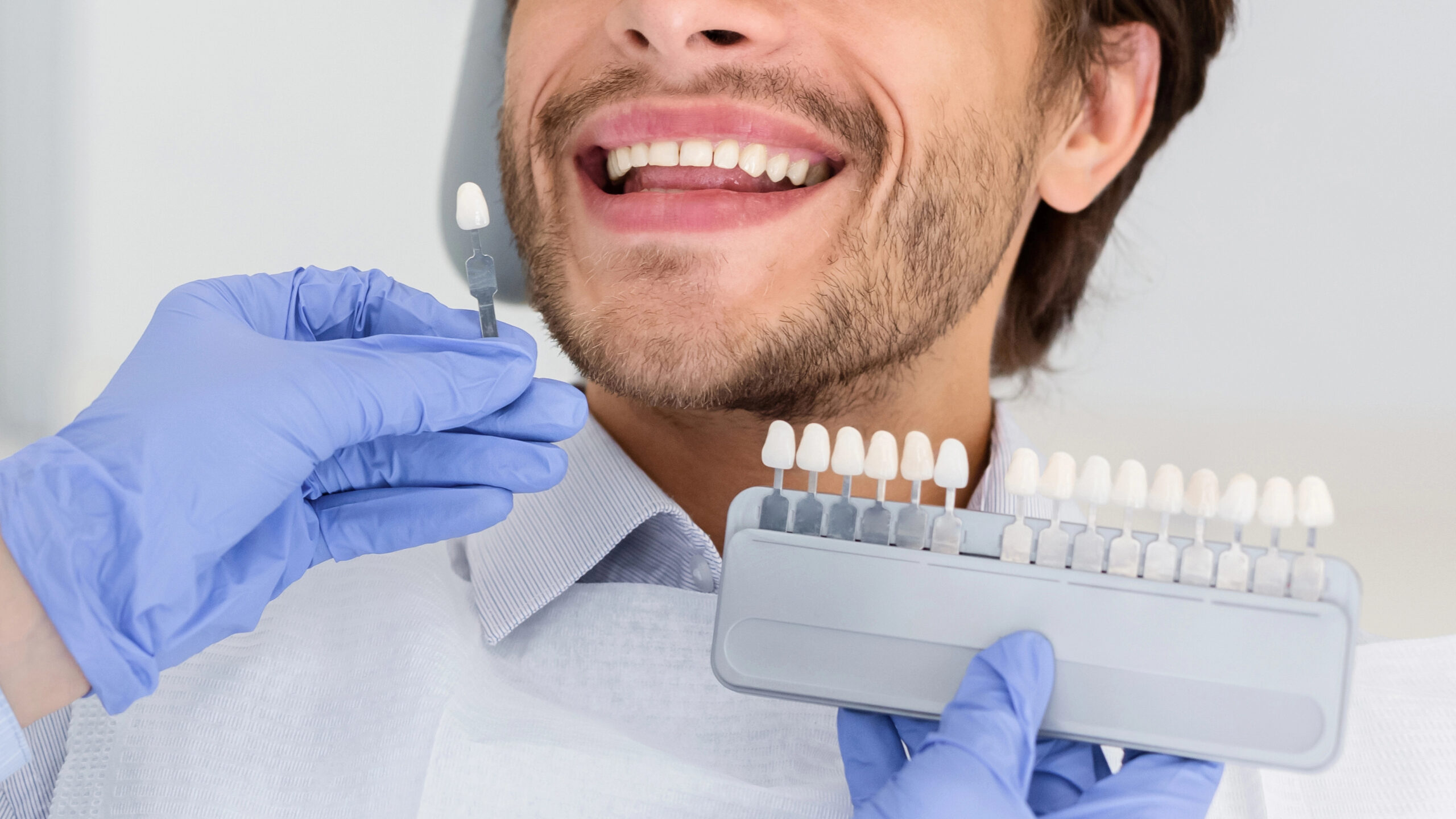 5 Reasons to Choose Professional Teeth Whitening