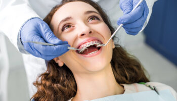How Dental Braces Actually Work