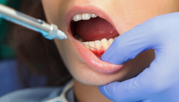 IV Sedation Dentistry in Brandon: A Safe Solution for Adults with Dental Anxiety